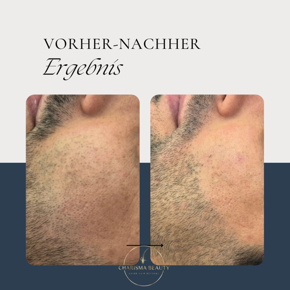 Creme-Schwarz-Elegant-Vorher-Nachher-Wimpern-Extensions-Instagram-Beitrag Creme-Schwarz-Elegant-Vorher-Nachher-Wimpern-Extensions-Instagram-Beitrag